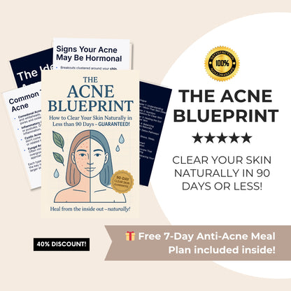 The Acne Blueprint - How to Clear Acne Within 90 Days Without Fancy Products or Potions
