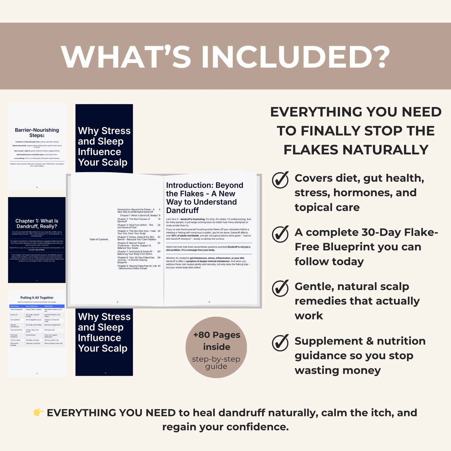 The Dandruff Solution: Heal Your Scalp Naturally in 30 Days or Less