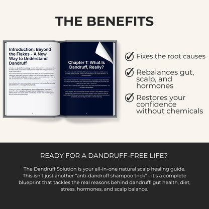 The Dandruff Solution: Heal Your Scalp Naturally in 30 Days or Less